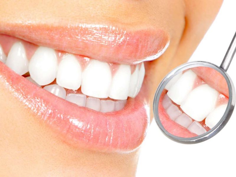 Sağlıklı Tercih Eryaman Diş