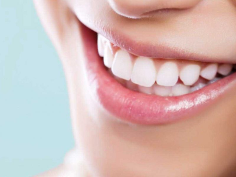 Çene Kemiğinin Diş Estetiğinde Etkisi Var Mıdır?